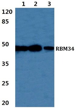 Invitrogen RBM34 Polyclonal Antibody 100 μL; Unconjugated:Antibodies,