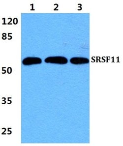 Invitrogen SRSF11 Polyclonal Antibody 100 &mu;L | Buy Online | Invitrogen&trade; | Fisher Scientific