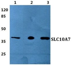 Invitrogen SLC10A7 Polyclonal Antibody 100 &mu;L; Unconjugated:Antibodies,
