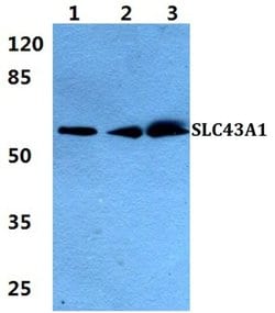 Invitrogen SLC43A1 Polyclonal Antibody 100 &mu;L | Buy Online | Invitrogen&trade; | Fisher Scientific
