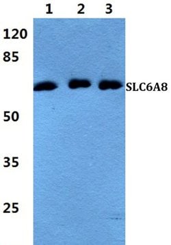 Invitrogen SLC6A8 Polyclonal Antibody 100 &mu;L; Unconjugated:Antibodies,