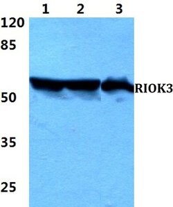 RIOK3 Polyclonal Antibody:Antibodies, Polyclonal