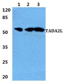 Invitrogen TADA2L Polyclonal Antibody 100 &mu;L; Unconjugated:Antibodies,