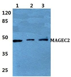 Invitrogen MAGEC2 Polyclonal Antibody 100 &mu;L; Unconjugated:Antibodies,