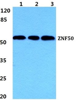 ZNF50 Polyclonal Antibody:Antibodies, Polyclonal