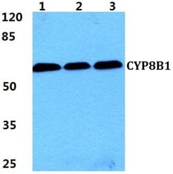 Invitrogen CYP8B1 Polyclonal Antibody 100 &mu;L; Unconjugated:Antibodies,