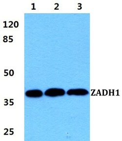 Invitrogen PTGR2 Polyclonal Antibody 100 &mu;L; Unconjugated:Antibodies,