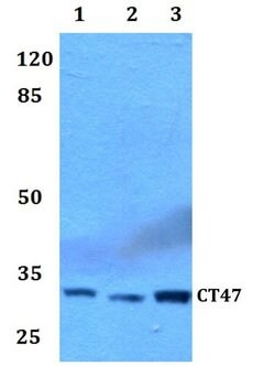 Invitrogen CT47 Polyclonal Antibody 100 &mu;L; Unconjugated:Antibodies,