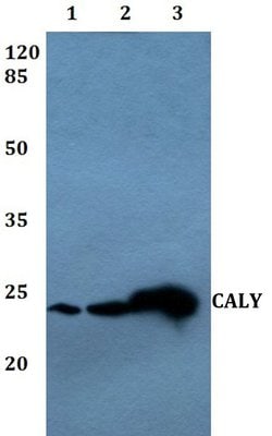 Invitrogen CALY Polyclonal Antibody 100 &mu;L; Unconjugated:Antibodies,