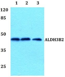 Invitrogen ALDH3B2 Polyclonal Antibody 100 &mu;L; Unconjugated:Antibodies,