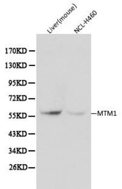 Invitrogen MTM1 Polyclonal Antibody 100 &mu;L; Unconjugated:Antibodies,