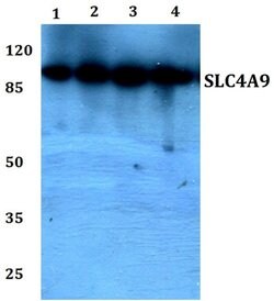 Invitrogen SLC4A9 Polyclonal Antibody 100 &mu;L; Unconjugated:Antibodies,