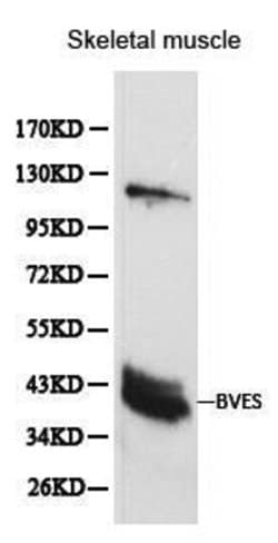 Invitrogen BVES Polyclonal Antibody 100 &mu;L; Unconjugated:Antibodies,