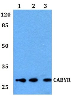 Invitrogen CABYR Polyclonal Antibody 100 &mu;L; Unconjugated:Antibodies,
