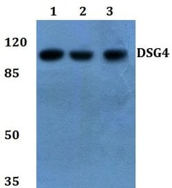 Invitrogen Desmoglein 4 Polyclonal Antibody 100 &mu;L; Unconjugated:Antibodies,