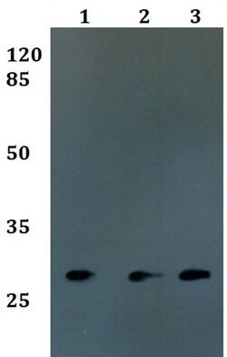 Invitrogen FOLR3 Polyclonal Antibody 100 μL; Unconjugated:Antibodies,