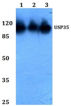 Invitrogen USP35 Polyclonal Antibody 100 &mu;L; Unconjugated:Antibodies,