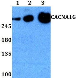 Invitrogen CaV3.1 Polyclonal Antibody 100 &mu;L; Unconjugated:Antibodies,