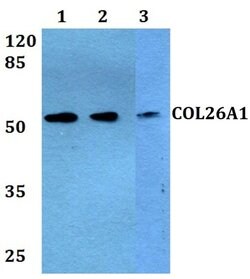 Invitrogen COL26A1 Polyclonal Antibody 100 &mu;L; Unconjugated:Antibodies,