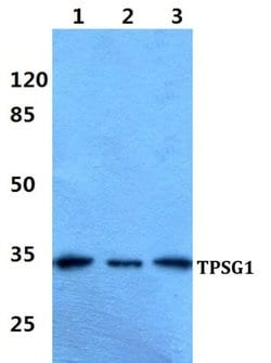 Invitrogen TPSG1 Polyclonal Antibody 100 μL; Unconjugated:Antibodies,
