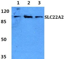 Invitrogen SLC22A2 Polyclonal Antibody 100 μL; Unconjugated:Antibodies,