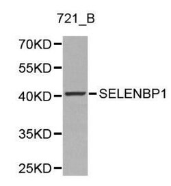 Invitrogen SELENBP1 Polyclonal Antibody 100 &mu;L; Unconjugated:Antibodies,