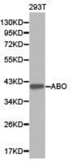 ABO Polyclonal Antibody:Antibodies, Polyclonal