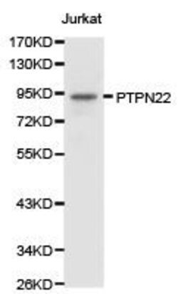 Invitrogen PTPN22 Polyclonal Antibody 100 &mu;L; Unconjugated:Antibodies,