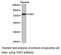 Invitrogen TAP2 Polyclonal Antibody 100 &mu;L | Buy Online | Invitrogen&trade; | Fisher Scientific