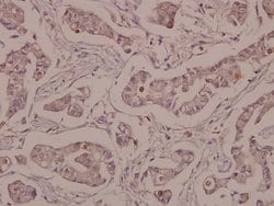 Invitrogen COL19A1 Polyclonal Antibody 100 &mu;L; Unconjugated:Antibodies,