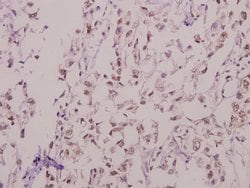 KV4.1 (KCND1) Polyclonal Antibody, Invitrogen 100 &mu;L; Unconjugated:Antibodies,