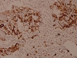 Invitrogen SPINK5 Polyclonal Antibody 100 μL; Unconjugated:Antibodies,