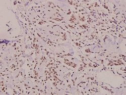 Invitrogen SH2D2A Polyclonal Antibody 100 &mu;L | Buy Online | Invitrogen&trade; | Fisher Scientific