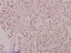 Invitrogen SLC30A1 Polyclonal Antibody 100 &mu;L; Unconjugated:Antibodies,