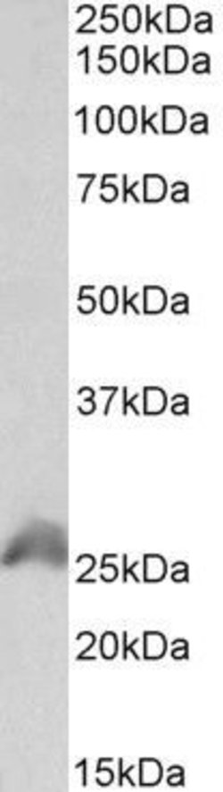 HOXB6 Polyclonal Antibody, Invitrogen 100 μg; Unconjugated:Antibodies,