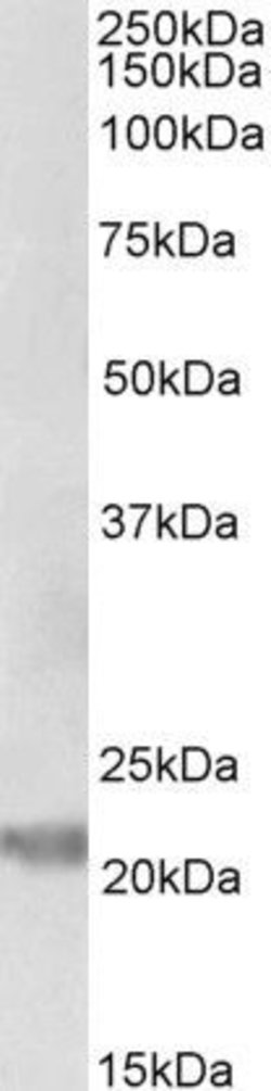 IL-25 Polyclonal Antibody, Invitrogen 100 &mu;g; Unconjugated:Antibodies,