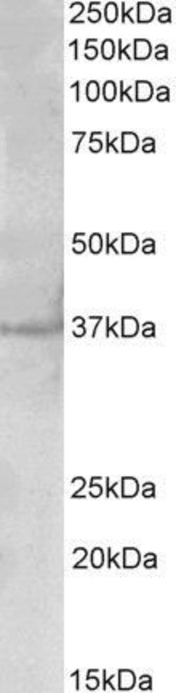 PLK5 Polyclonal Antibody, Invitrogen 100 &mu;g; Unconjugated:Antibodies,