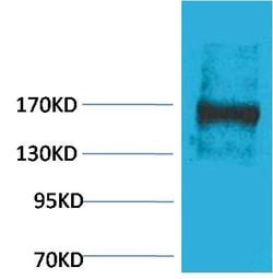 EPG5 Polyclonal Antibody, Invitrogen 100 &mu;g; Unconjugated:Antibodies,