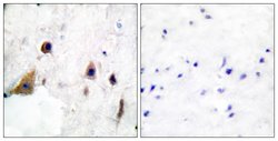 Phospho-DARPP-32 (Thr75) Polyclonal Antibody, Invitrogen 100 &mu;g; Unconjugated:Antibodies,