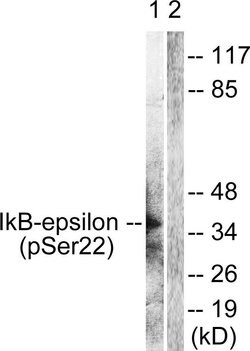 Phospho-IkB epsilon (Ser22) Polyclonal Antibody, Invitrogen 100 &mu;g;