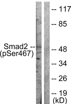 Phospho-SMAD2 (Ser467) Polyclonal Antibody, Invitrogen 100 &mu;g | Buy Online | Invitrogen | Fisher Scientific
