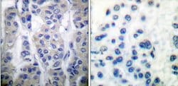 Invitrogen Phospho-LIMK1/LIMK2 (Thr508, Thr505) Polyclonal Antibody 100