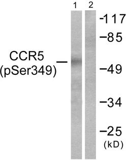 Phospho-CCR5 (Ser349) Polyclonal Antibody, Invitrogen 100 &mu;g; Unconjugated:Antibodies,