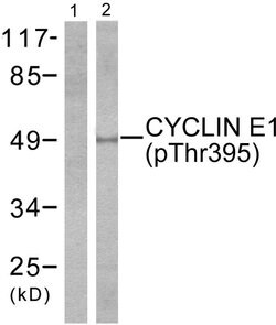 Phospho-Cyclin E (Thr395) Polyclonal Antibody, Invitrogen 100 &mu;g; Unconjugated:Antibodies,