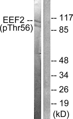 Phospho-EEF2 (Thr56) Polyclonal Antibody, Invitrogen 100 &mu;g | Buy Online | Invitrogen | Fisher Scientific