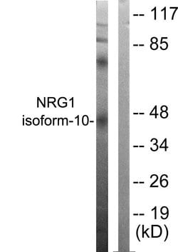 NRG1 Isoform 10 Polyclonal Antibody, Invitrogen 100 &mu;g | Buy Online | Invitrogen | Fisher Scientific