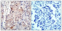Phospho-ErbB2 (HER-2) (Tyr1221, Tyr1222) Polyclonal Antibody, Invitrogen