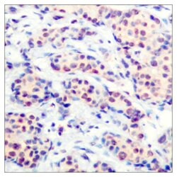 JunD Polyclonal Antibody, Invitrogen 100 &mu;g; Unconjugated:Antibodies