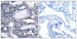 Phospho-MEK2 (Thr394) Polyclonal Antibody, Invitrogen 100 &mu;g; Unconjugated:Antibodies,