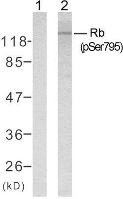 Phospho-Rb (Ser795) Polyclonal Antibody, Invitrogen 100 &mu;g | Buy Online | Invitrogen | Fisher Scientific